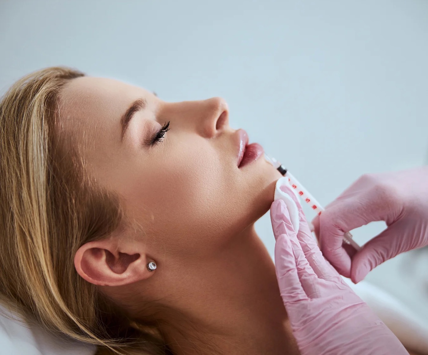 Dermal filler treatment at Ageless Health Institute in Phoenix, AZ